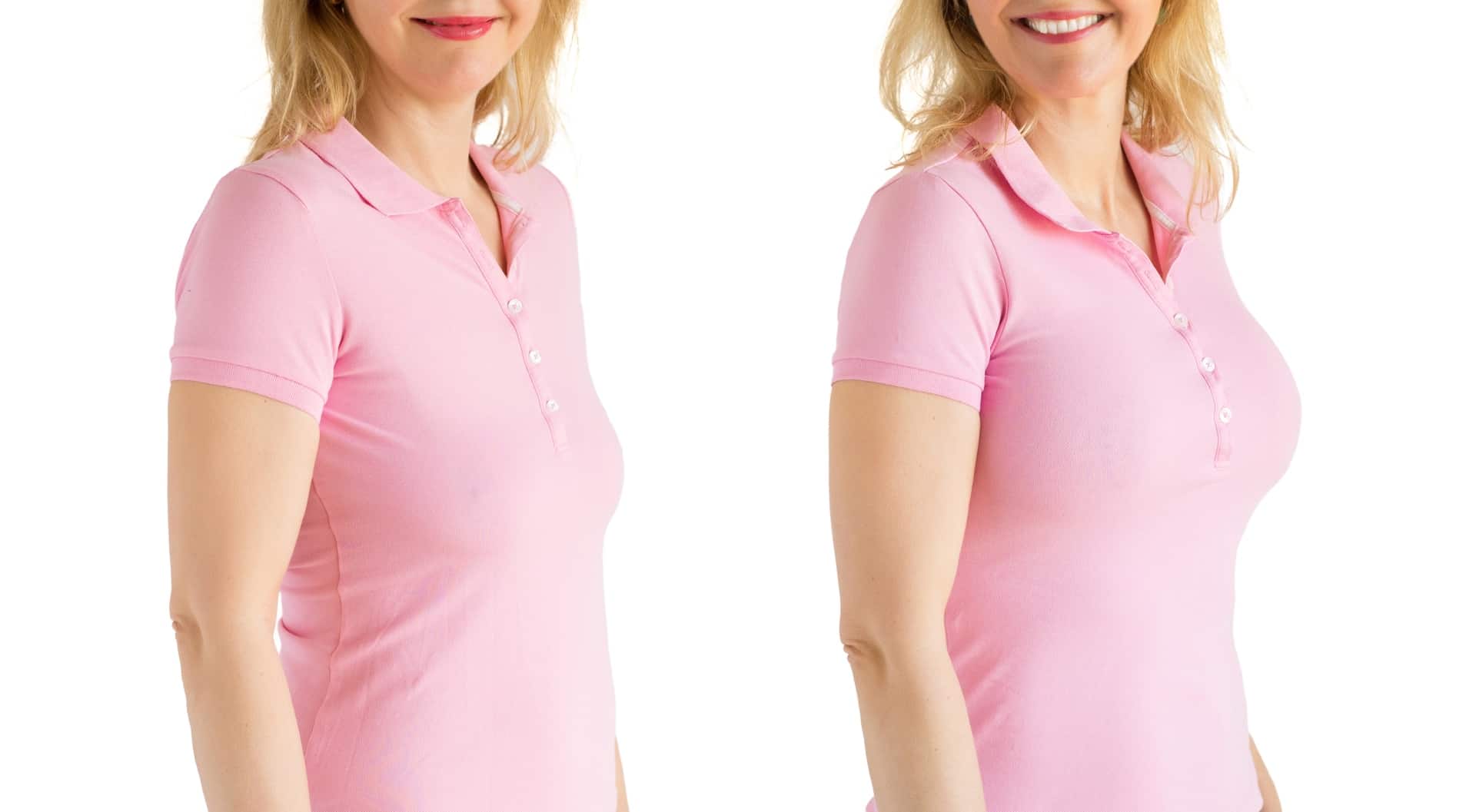 Die Brust Op Vorher Nachher Bilder