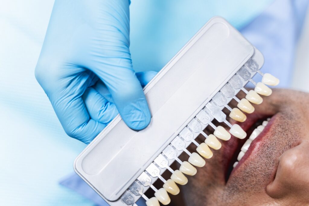 Direkte und wirksame Zahnimplantat Kosten