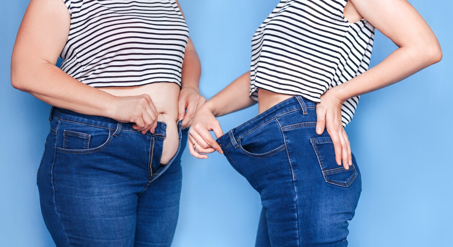 Fettabsaugung Bauch vorher nachher Bildern 2022